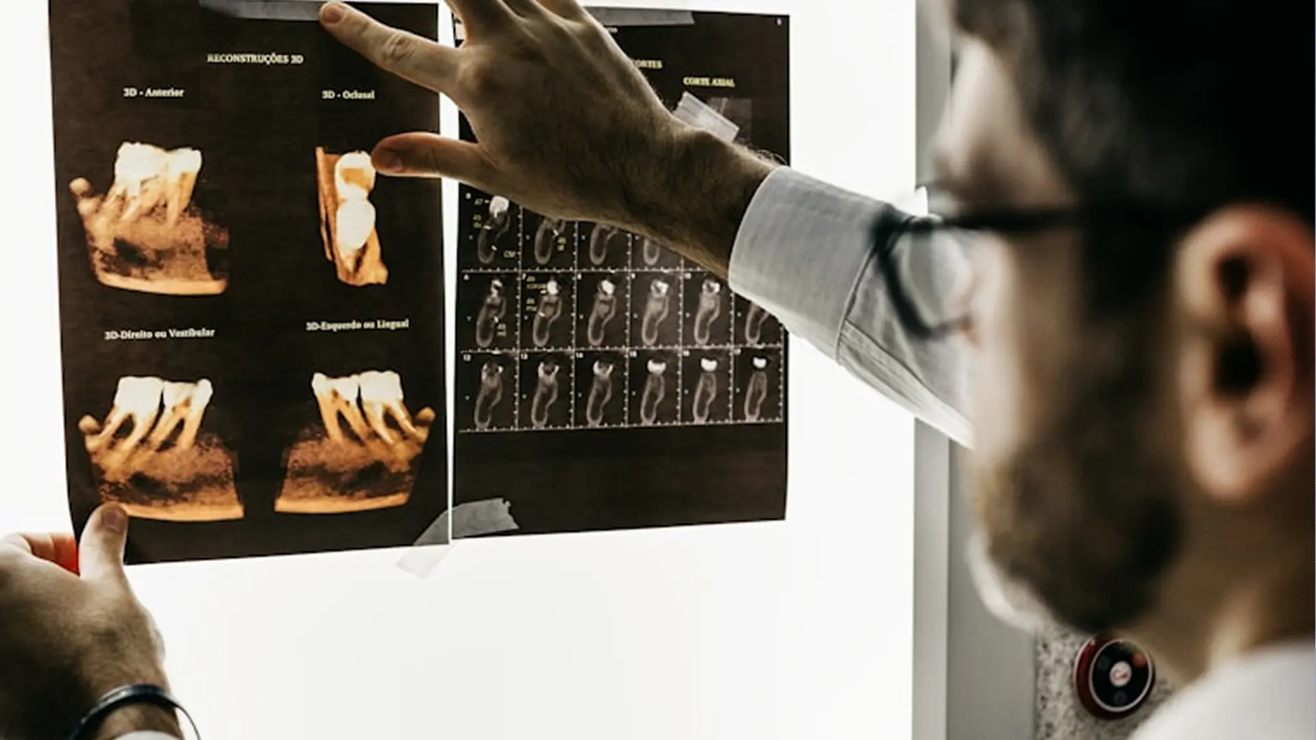 AI-Enabled Early Disease Prediction & Prevention - EXR Webflow